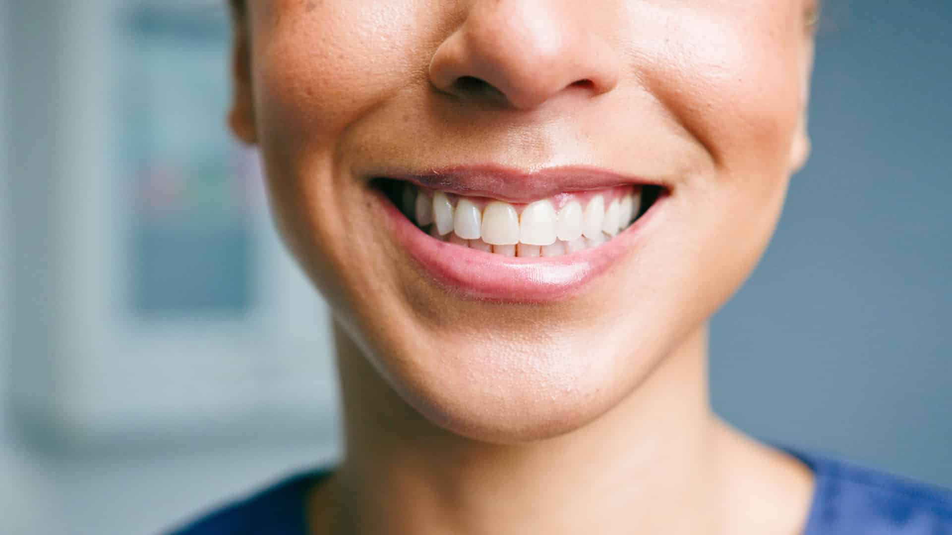 Tooth Remineralization: An In-Depth Understanding