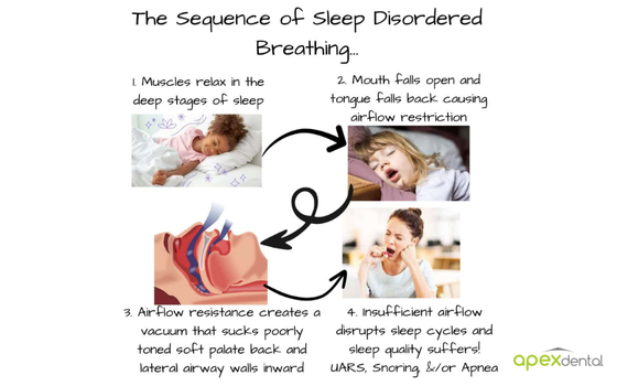 An Airway Muscle Workout for Better Sleep and More Endurance!