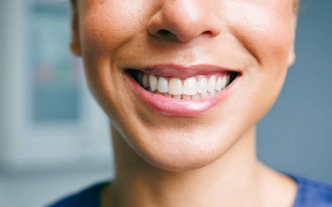Tooth Remineralization: An In-Depth Understanding