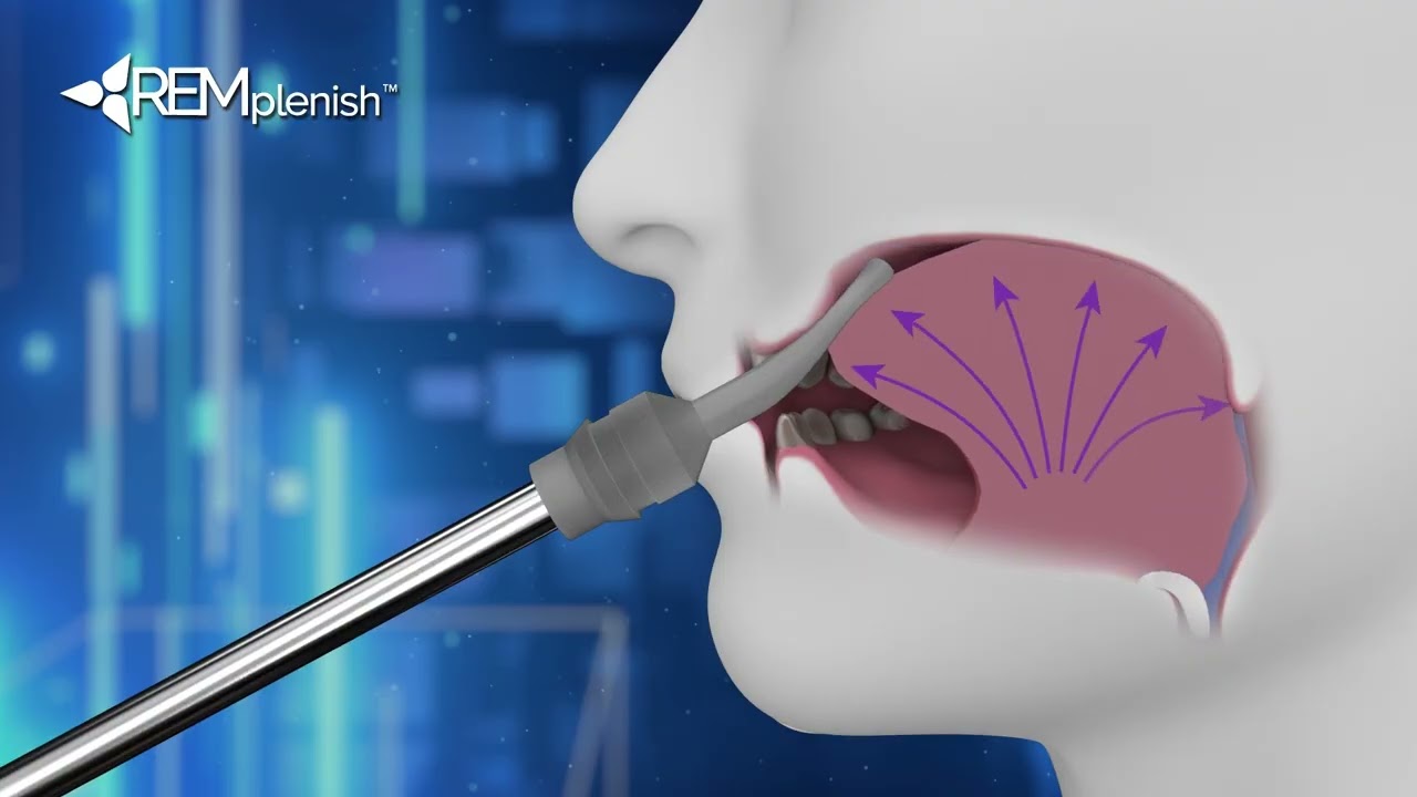 Proper Use of Your REMplenish Myofunctional Straw